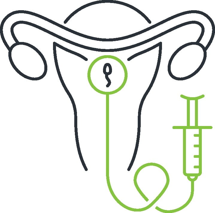 Fertina - inseminacja